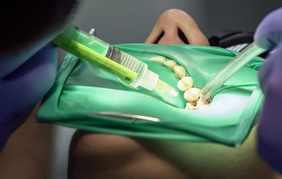 Endodoncia